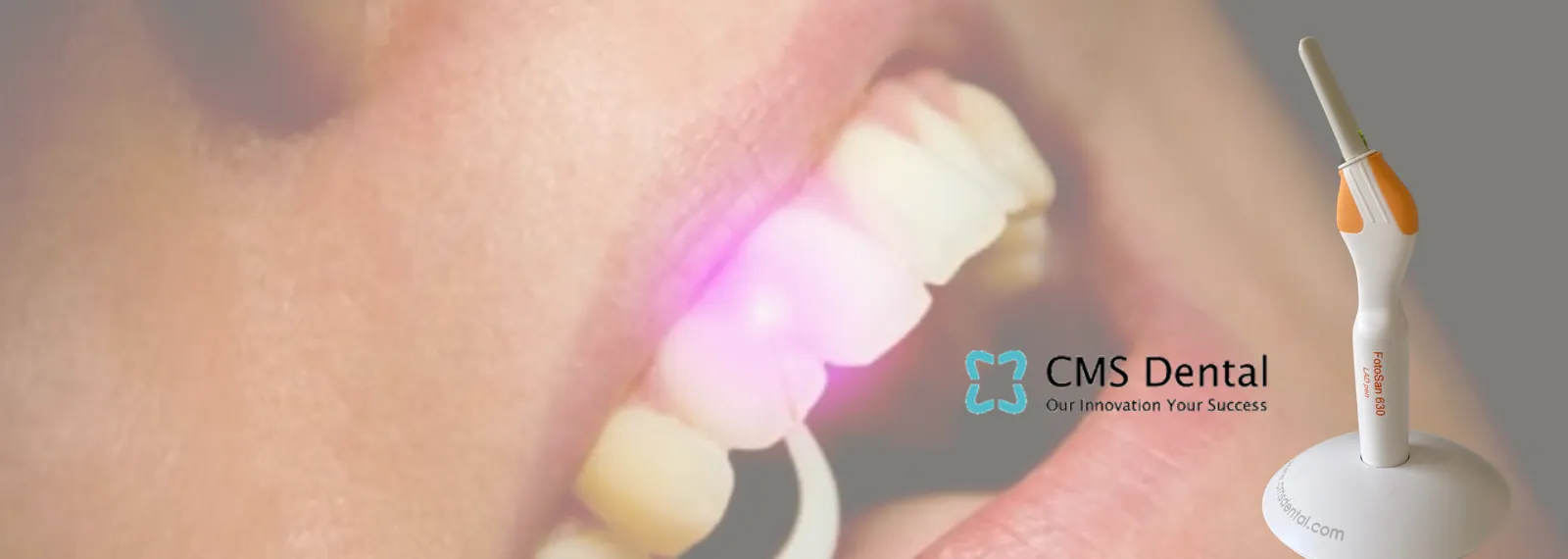 Láser FotoSan 630 (terapia fotodinámica)